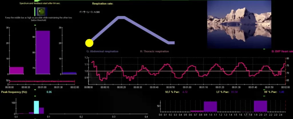 心拍変動バイオフィードバックで痛みを治療