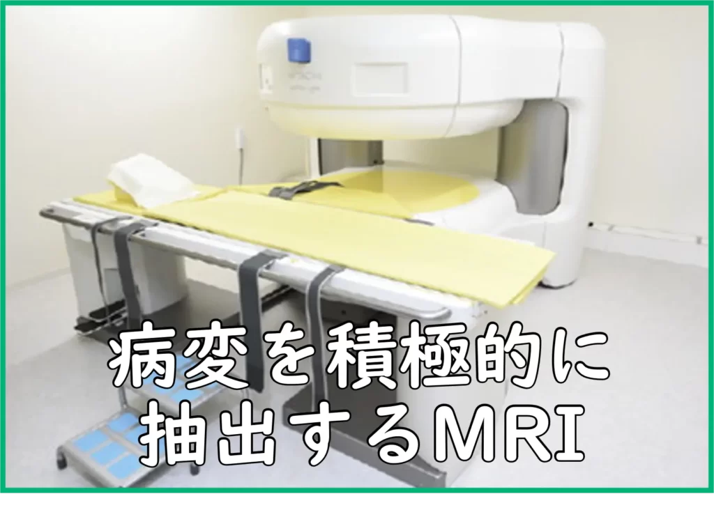 病変を積極的に抽出するMRI