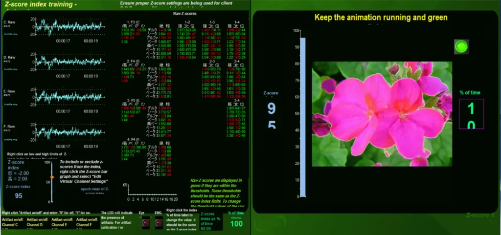 Z-score monitor picture 